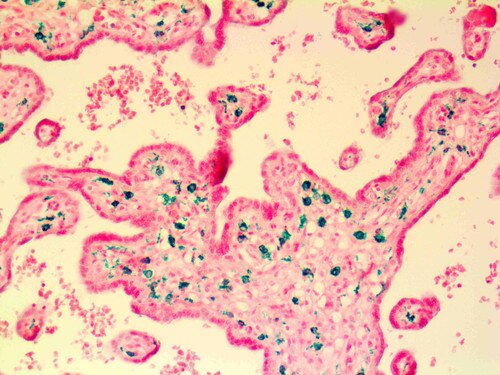 IHC of CD163 on an FFPE Placenta Tissue